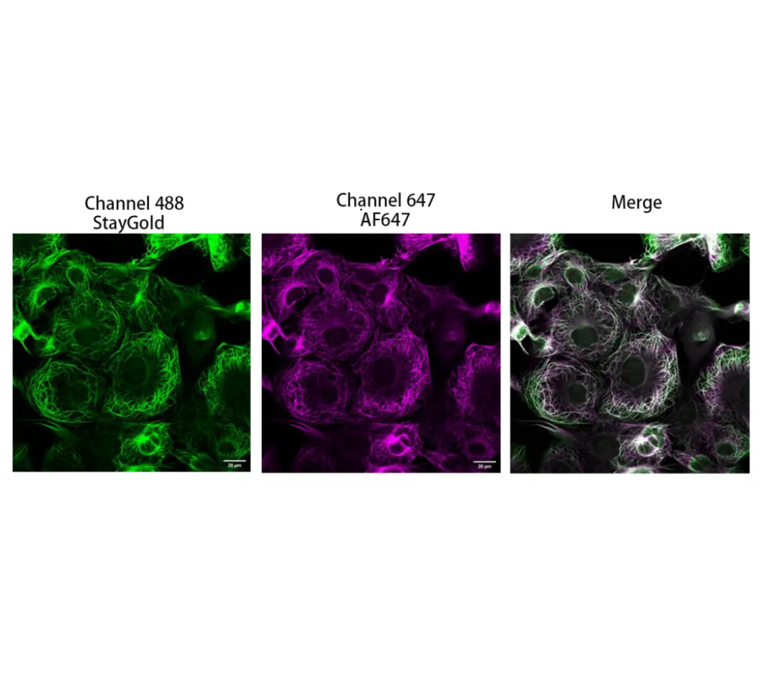 StayGold Nanobodies – A Powerful New Research Tool for Fluorescent Protein Studies